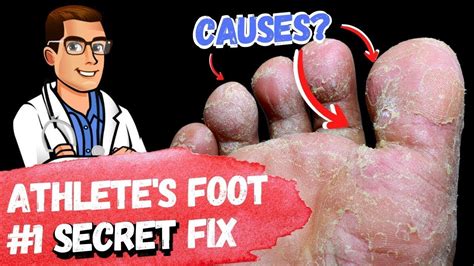 the athlete's foot fake shoes|athlete's foot scratch.